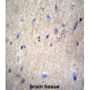 NEDD8 Activating Enzyme E1 Subunit 1 (NAE1) Antibody
