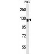 Netrin Receptor UNC5D (UNC5D) Antibody