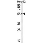 UDP-Glucuronic Acid Decarboxylase 1 (UXS1) Antibody