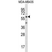 Fascin 3 (FSCN3) Antibody