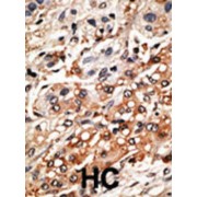 Bmf BH3 Domain Antibody