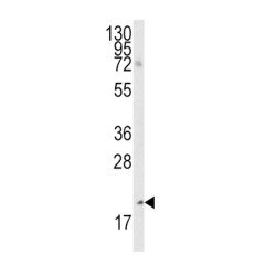 Bmf BH3 Domain Antibody