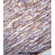 RAS, Dexamethasone-Induced 1 (RASD1) Antibody