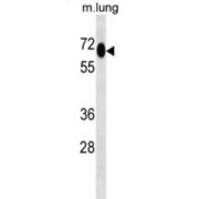 7SK snRNA Methylphosphate Capping Enzyme (MEPCE) Antibody