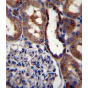 Glutamate Receptor Ionotropic, Kainate 3 (GRIK3) Antibody