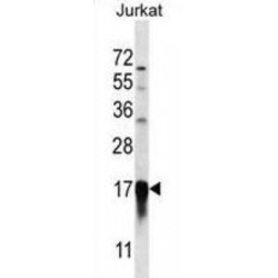 Prefoldin Subunit 5 (PFDN5) Antibody