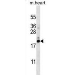 Prefoldin Subunit 5 (PFDN5) Antibody