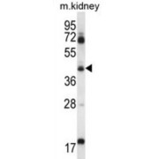 Acyl-CoA Dehydrogenase, Long Chain (ACADL) Antibody