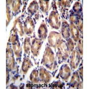 Retinoic Acid Receptor Responder 1 (RARRES1) Antibody
