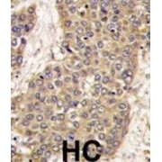 Caspase 6 (CASP6) Antibody