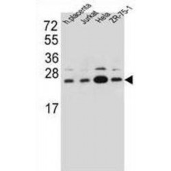 Translocon-Associated Protein Subunit Beta (SSR2) Antibody