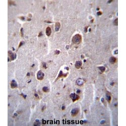 Transmembrane Protein 55B (TM55B) Antibody