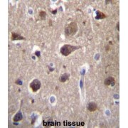 Melanocortin 2 Receptor Accessory Protein 2 (MRAP2) Antibody