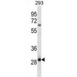 Melanocortin 2 Receptor Accessory Protein 2 (MRAP2) Antibody