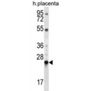 LHFPL Tetraspan Subfamily Member 1 Protein (LHFPL1) Antibody