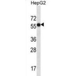 Carboxypeptidase N2 (CPN2) Antibody