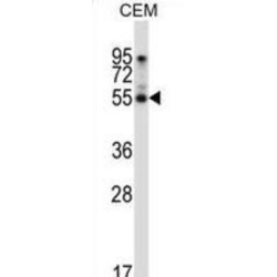 Palmdelphin (PALMD) Antibody