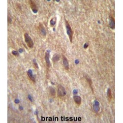 Fibroblast Growth Factor 11 (FGF11) Antibody