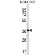 THAP Domain-Containing Protein 8 (THAP8) Antibody
