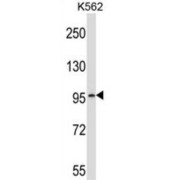Phosphodiesterase 6A (PDE6A) Antibody