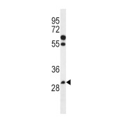 WB analysis of NCI-H460 cell line lysates.