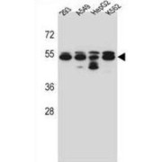 Tubulin Beta-8 Chain (TUBB8) Antibody