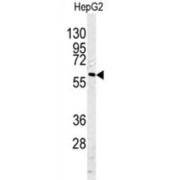 Caspase 10 (CASP10) Antibody
