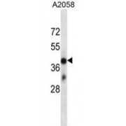 Olfactory Receptor Family 4 Subfamily D Member 6 (OR4D6) Antibody