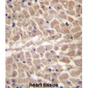 IHC-P analysis with DAB staining, of Human heart tissue, using TRIM11 antibody followed by a secondary antibody conjugated to peroxidase.