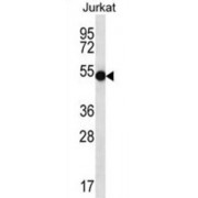 Battenin (CLN3) Antibody