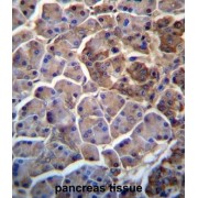 MOSPD2 Antibody