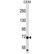 Zinc Finger Protein 443 (ZNF443) Antibody