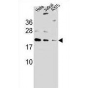 ADP-Ribosylation-Like Factor 6 Interacting Protein 6 (ARL6IP6) Antibody