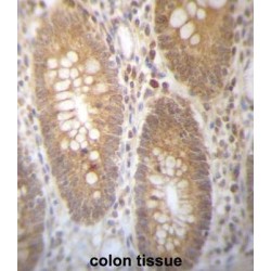 Dehydrogenase/Reductase SDR Family Member 7B (DHRS7B) Antibody