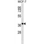 WB analysis of MCF-7 cell line lysates.