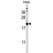 Transmembrane Gamma-Carboxyglutamic Acid Protein 1 (PRRG1) Antibody