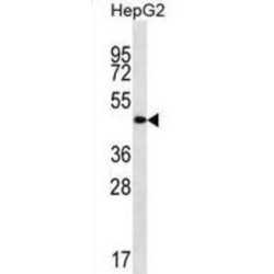 Transmembrane And Coiled-Coil Domain Protein 3 (TMCC3) Antibody
