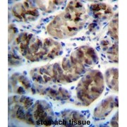 Zinc Finger DHHC-Type Containing 20 (ZDHHC20) Antibody