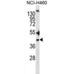 Zinc Finger DHHC-Type Containing 20 (ZDHHC20) Antibody