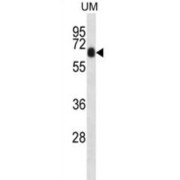 Coiled-Coil Domain Containing 120 (CCDC120) Antibody