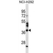 Spermatogenesis-Associated Protein 4 (SPATA4) Antibody