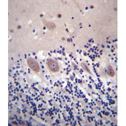 Calcium Voltage-Gated Channel Auxiliary Subunit Alpha2delta 2 (CACNA2D2) Antibody