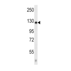 Calcium Voltage-Gated Channel Auxiliary Subunit Alpha2delta 2 (CACNA2D2) Antibody
