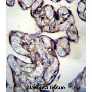 abx027379