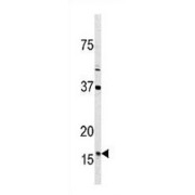 Thioredoxin 2 (TXN2) Antibody