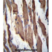 Transforming Growth Factor-Beta Receptor-Associated Protein 1 (TGFBRAP1) Antibody