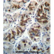 Connective Tissue Growth Factor (CCN2) Antibody