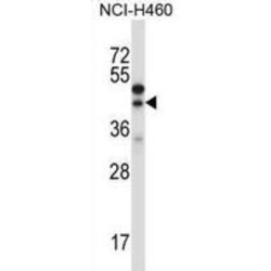 Connective Tissue Growth Factor (CCN2) Antibody