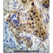 Ribosomal Protein L3 (RPL3) Antibody