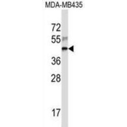 Ribosomal Protein L3 (RPL3) Antibody